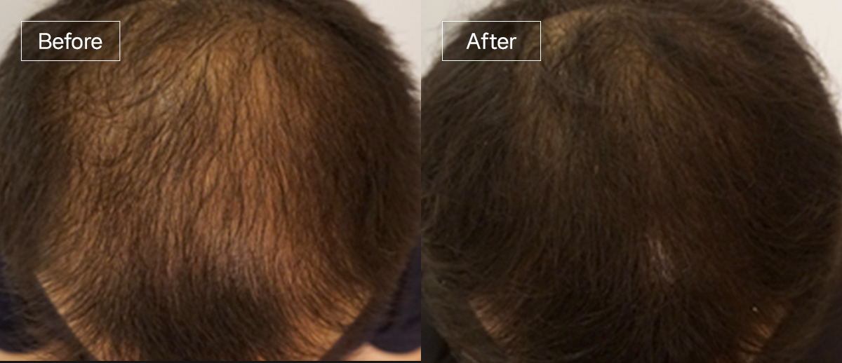 /filedata/md_board/20260102170106_x60sal7r_sub4_slide10.jpg 전후사진