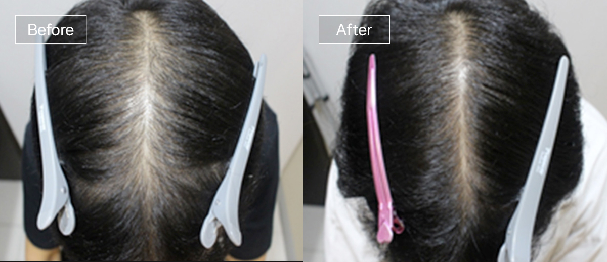 /filedata/md_board/20260102170128_tj9HXhZ0_sub4_slide8.jpg 전후사진