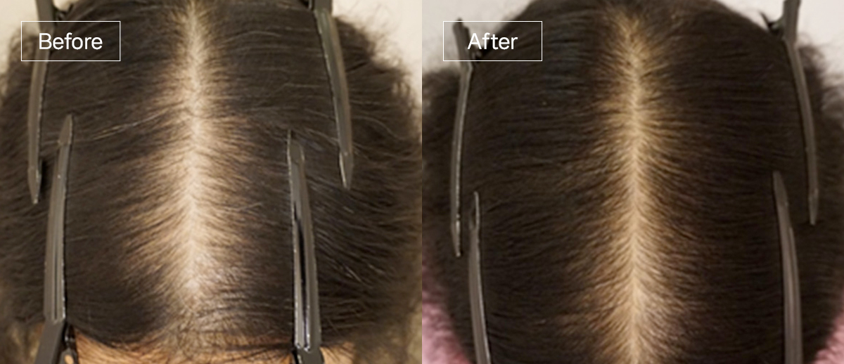 /filedata/md_board/20260102170223_IibRQC7u_sub4_slide3.jpg 전후사진