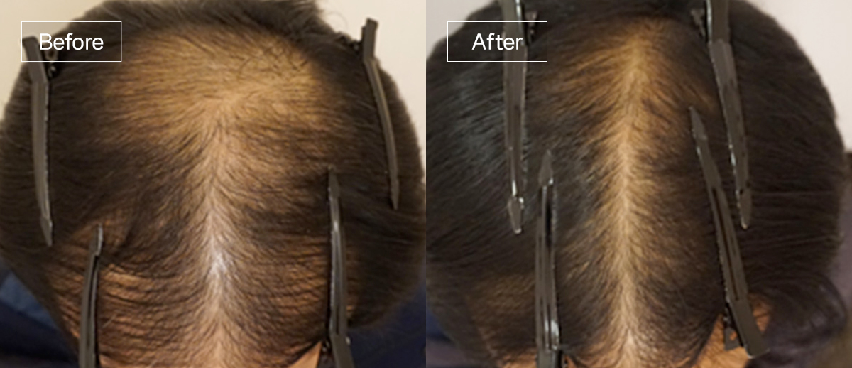 /filedata/md_board/20260102170246_e5zA2OS9_sub4_slide1.jpg 전후사진