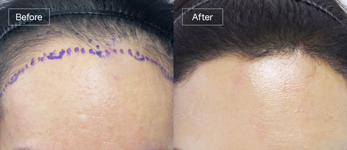 /filedata/md_board/20260102171811_7PBf08Ka_sub3_slide6.jpg 전후사진