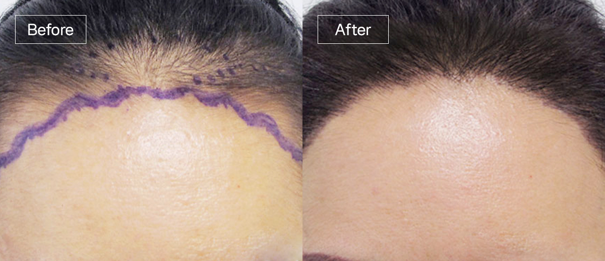 /filedata/md_board/20260102171821_asQCuOiD_sub3_slide5.jpg 전후사진