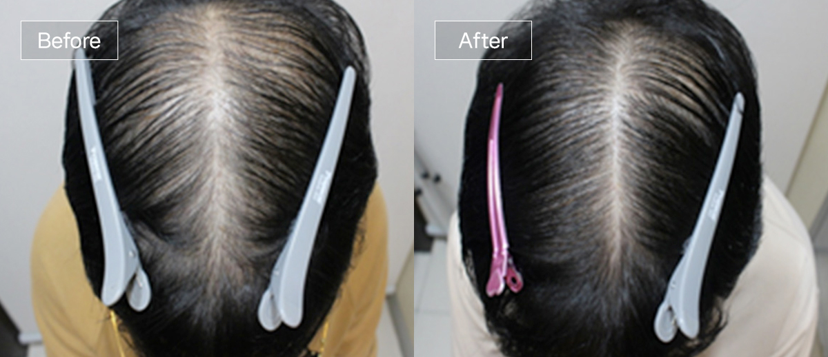 /filedata/md_board/20260102172137_HNGY0xJW_sub4_slide9.jpg 전후사진