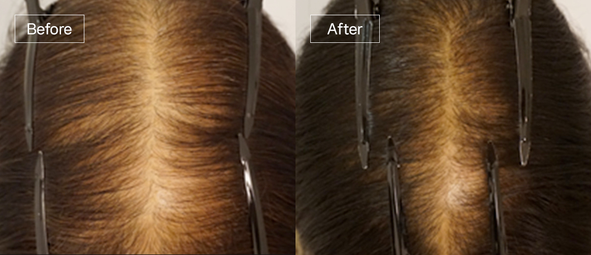 /filedata/md_board/20260102172159_G7NMZUiL_sub4_slide7.jpg 전후사진