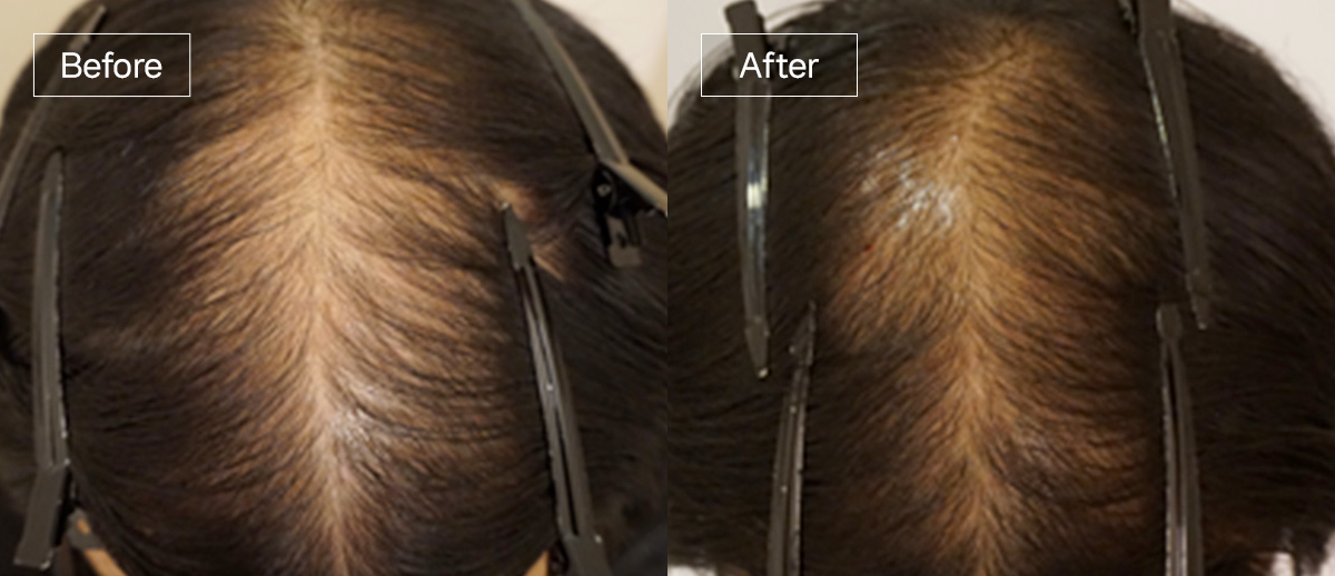 /filedata/md_board/20260102172208_BxlmqXGb_sub4_slide6.jpg 전후사진