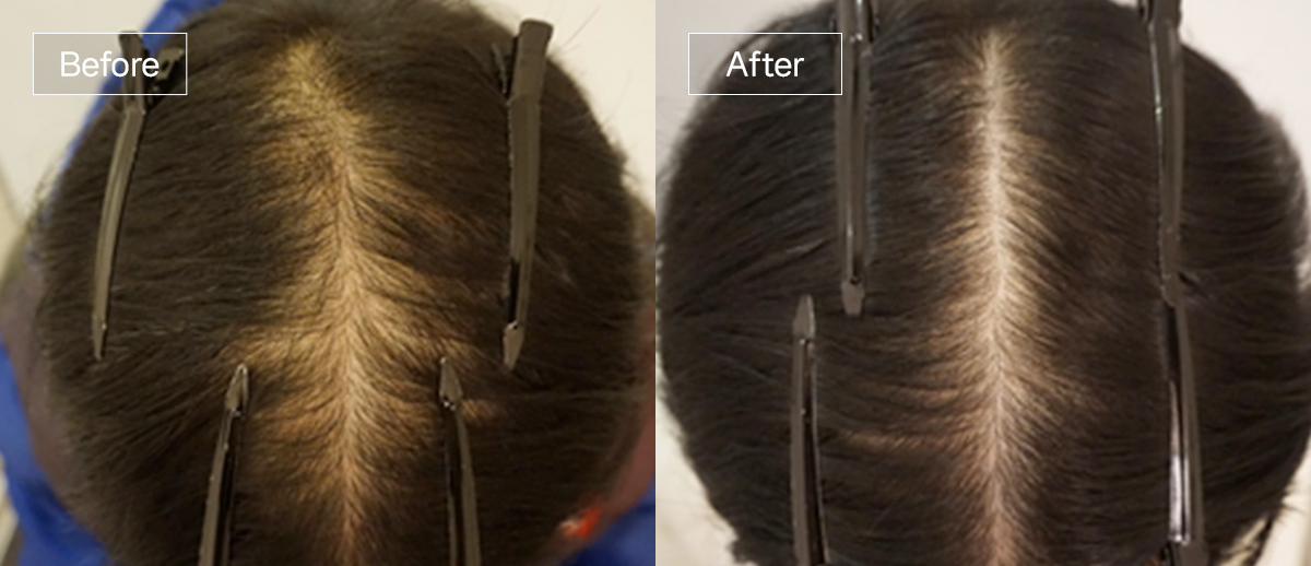 /filedata/md_board/20260102172253_ThOqefPE_sub4_slide4.jpg 전후사진