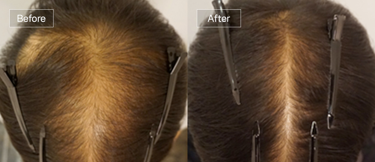 /filedata/md_board/20260102172311_1Vc5LxBO_sub4_slide2.jpg 전후사진